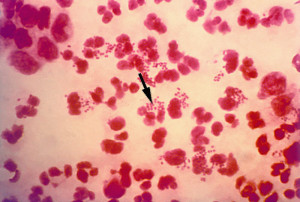 Neisseria-gonorrhoeae